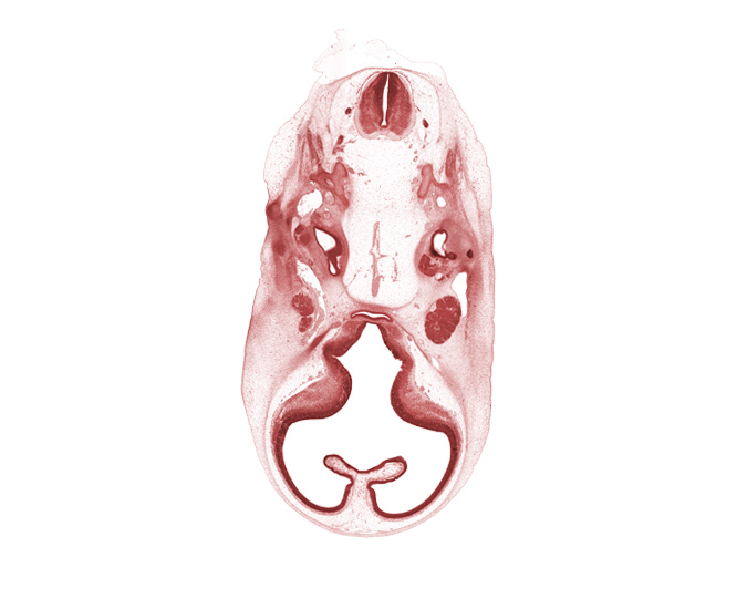 abducens nerve (CN VI), accessory nerve (CN XI), adenohypophysis, basilar artery, central canal, choroid fissure, facial nerve (CN VII), glossopharyngeal nerve (CN IX), hypoglossal nerve (CN XII), lateral semicircular duct, optic groove, primary head vein, spinal accessory nerve (CN XI), stem of anterior dural venous plexus, stem of middle dural venous plexus, striatal part of cerebral vesicle (telencephalon), subarachnoid space, suprastriatal part of cerebral vesicle (telencephalon), vagus nerve (CN X), ventricular eminence(s), vertebral artery, vestibulocochlear ganglion (CN VIII)