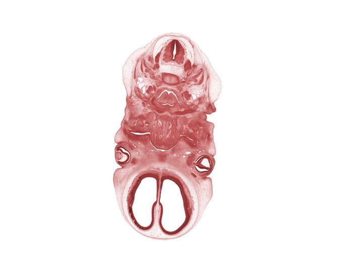 C-2 / C-3 intervertebral disc, C-3 spinal ganglion, C-3 spinal nerve, T-shaped larynx lumen, U-shaped laryngeal pharynx, blastema of extra-ocular muscle(s), glossopharyngeal nerve (CN IX), intraretinal space (optic vesicle cavity), neural layer of retina, palatine shelf, pigmented layer of retina, precardinal vein, spinal accessory nerve (CN XI), thyroglossal duct remnant, vertebral artery, vitreous cavity