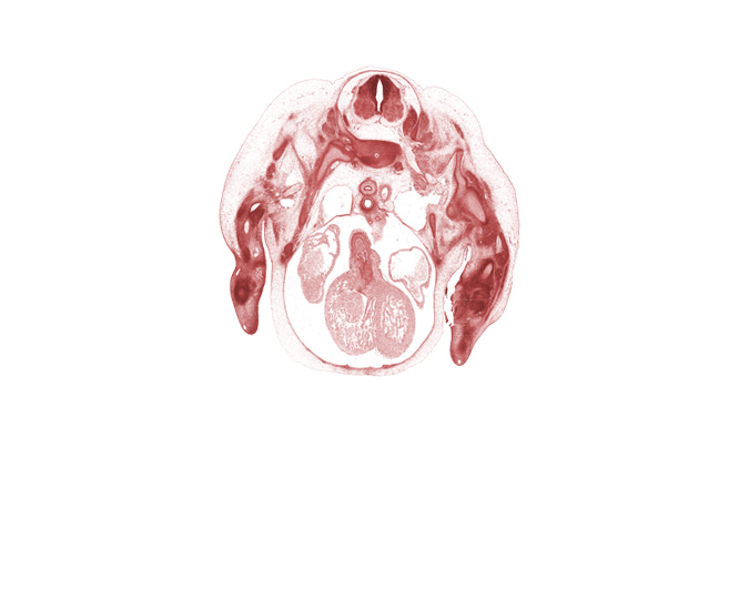 C-7 / T-1 intervertebral disc, C-7 ventral ramus, C-8 spinal ganglion, C-8 spinal nerve, aorta, aorticopulmonary septum region, artifact separation(s), ascending aorta, dorsal fasciculus, esophagus, glenohumeral joint, head of humerus, heart prominence, interventricular sulcus, left atrium, osteogenic layer, pulmonary trunk, radial nerve, radius, rib 1, right pulmonary artery, scapula, serratus anterior muscle, trabecular part of left ventricle, trabecular part of right ventricle, trachea