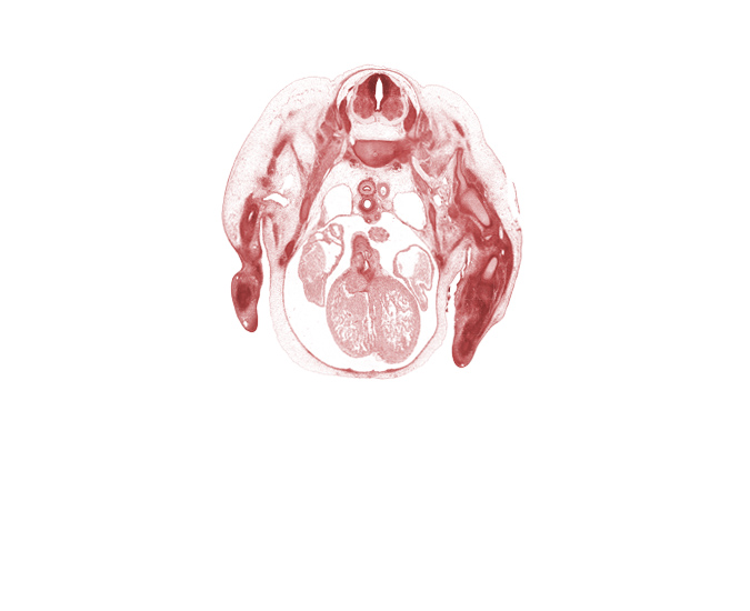 C-7 / T-1 intervertebral disc, C-8 spinal ganglion, C-8 spinal nerve, aorticopulmonary septum region, blastemata of extensor muscles in forearm, edge of left atrium, edge of pleural cavity, glenohumeral joint, interventricular sulcus, left atrium, left ventricle, lower trunk of brachial plexus (C-8, T-1), middle trunk of brachial plexus (C-7), pericardial cavity, rib 1, right atrium, right precardinal vein, right pulmonary artery, right ventricle, sympathetic trunk, upper trunk of brachial plexus (C-5, C-6)