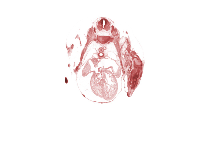 T-2 spinal ganglion, aorta, artifact separation(s), edge of hand, edge of pleural cavity, esophagus, head of rib 2, interventricular foramen, left atrium, left precardinal vein, left pulmonary artery, mammary gland, primary interatrial septum (septum primum) remnant, right atrioventricular canal, right atrium, right precardinal vein, secondary interatrial septum (septum secundum), sympathetic trunk, ventral horn of grey matter