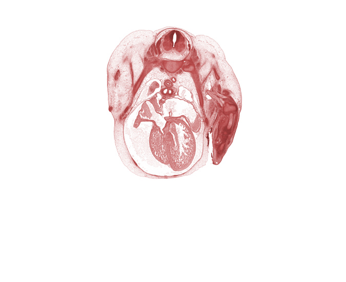 apex of right lung, artifact separation(s), caudal edge of T-2 spinal ganglion, edge of left pleural cavity, head of rib 2, junction of right precardinal vein and sinus venosus, left atrium, left vagus nerve (CN X), left venous valve, left ventricle, mammary gland, neural arch, pericardial cavity, rib 3, rib 4, right atrioventricular (tricuspid) valve, right primary bronchus, right venous valve, right ventricle, scapula, secondary interatrial septum (septum secundum), sympathetic trunk, tracheal bifurcation