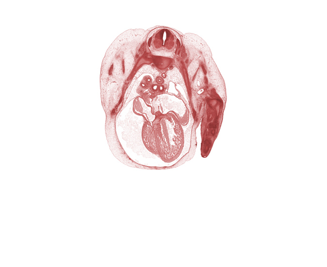 T-2 / T-3 intervertebral disc, T-2 intercostal nerve, T-2 spinal nerve, T-3 spinal ganglion, artifact separation(s), communicating ramus, edge of pleural cavity, interventricular sulcus, left horn of sinus venosus, left primary bronchus, left ventricle, pericardial cavity, pleural cavity, primary interatrial septum (septum primum) remnant, rib 3, rib 4, right atrioventricular canal, right atrium, right primary bronchus, right vagus nerve (CN X), right ventricle, secondary interatrial foramen (foramen secundum), sinus venosus, sympathetic trunk