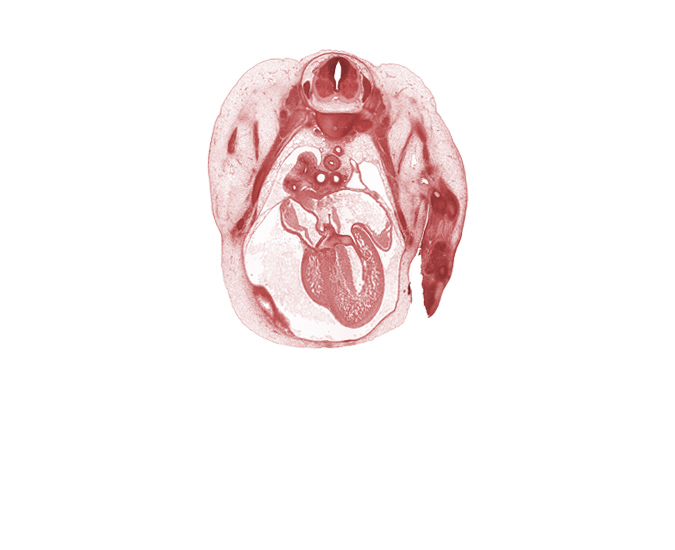 T-3 spinal ganglion, alar plate(s), artifact separation(s), atrioventricular endocardial cushion(s), basal plate, bronchopulmonary bud(s), edge of peritoneal cavity, floor plate, head of rib 4, latissimus dorsi muscle, left atrioventricular canal, left common cardinal vein, left postcardinal vein, left precardinal vein, left ventricle, pericardial cavity, pleural cavity, primary interatrial septum (septum primum) remnant, right atrium, right primary bronchus, right ventricle, roof plate, secondary interatrial foramen (foramen secundum), sulcus limitans, upper lobe of right lung