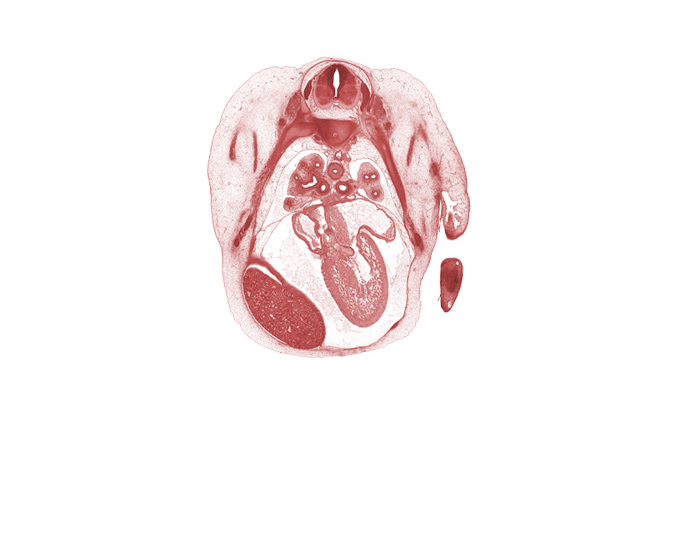 T-4 / T-5 intervertebral disc, T-4 intercostal nerve, T-4 spinal ganglion, anterior tertiary bronchus, aorta, atrioventricular endocardial cushion(s), central canal, horizontal fissure, left atrioventricular canal, left atrium, left horn of sinus venosus, left postcardinal vein, left ventricle, middle lobe of right lung, pericardial cavity, peritoneal cavity, phrenic nerve, posterior tertiary bronchus, primary bronchus, rib 4, rib 5, right atrium, sinus venosus, upper lobe of left lung, upper lobe of right lung, upper secondary bronchus