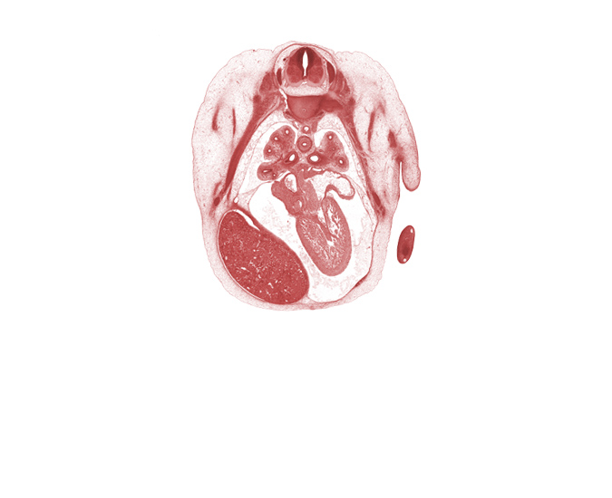 T-4 intercostal nerve, T-4 spinal ganglion, aorta, head of rib 5, heart prominence, horizontal fissure, latissimus dorsi muscle, left horn of sinus venosus, left ventricle, liver prominence, marginal vein, middle lobe of right lung, musculi pectinati, primary bronchus, pulmonary vein(s), rib 5, right atrium, right lobe of liver, right postcardinal vein (azygos vein), serratus anterior muscle, sympathetic trunk, upper lobe of left lung, upper lobe of right lung