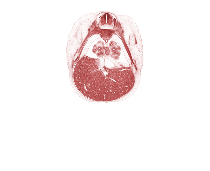 T-6 intercostal nerve, T-6 spinal ganglion, aorta, central canal, inferior vena cava, junction of efferent hepatic veins and inferior vena cava, lateral basal tertiary bronchus of right lung, left efferent hepatic vein, lingula of upper lobe of left lung, liver prominence, lower lobe of left lung, medial basal tertiary bronchus of right lung, oblique fissure, pulmogenic coat, rib 7, rib 8, right efferent hepatic vein, sympathetic trunk