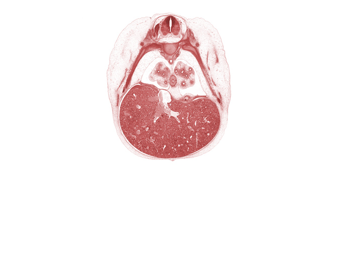 T-6 / T-7 interganglion region, T-7 intercostal nerve, anterior medial basal tertiary bronchus, aorta, central tendon of diaphragm, cephalic edge of umbilical cord, common efferent hepatic vein, inferior vena cava, left lobe of liver, lower lobe of left lung, pulmogenic coat, rib 7, rib 8, right lobe of liver, subarachnoid space, surface ectoderm, sympathetic trunk