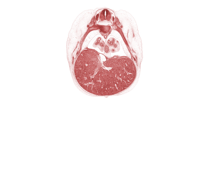 T-7 spinal ganglion, aorta, dorsal meso-esophagus, esophagus, inferior vena cava, left lobe of liver, left vagus nerve (CN X), pleural cavity, pleural recess, rib 7, rib 8, right lobe of liver, ventral horn of grey matter