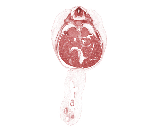 T-9 intercostal nerve, T-9 spinal ganglion, afferent hepatic vein, aorta, celiac ganglion, cephalic edge of gall bladder, cephalic edge of herniated midgut, ductus venosus, falciform ligament, fundus of stomach, head of rib 10, inferior vena cava, omphalomesenteric artery, posterior intercostal artery, rib 10, suprarenal gland cortex, umbilical coelom