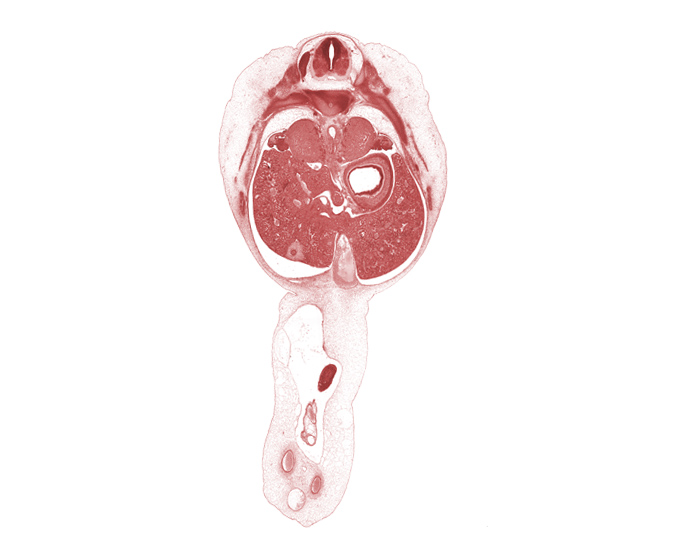 T-10 intercostal nerve, T-9 / T-10 interganglion region, celiac trunk, external abdominal oblique muscle, gall bladder, hepatic portal vein, internal abdominal oblique muscle, junction of ductus venosus and umbilical vein, left lobe of liver, lumen of body of stomach, omphalomesenteric artery, quadrate lobe of liver, rectus abdominis muscle, rib 10, rib 11, right lobe of liver, spleen, subarachnoid space, suprarenal gland medulla, sympathetic trunk, transversus abdominis muscle, umbilical coelom, wall of herniated midgut