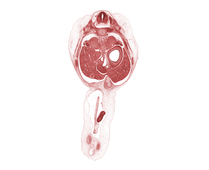 T-10 intercostal nerve, T-10 spinal ganglion, allantois, aorta, distal limb of herniated midgut, edge of superior mesenteric artery, gall bladder, hepatic portal vein, intermediate zone, left lobe of liver, left umbilical artery, lesser sac (omental bursa), lumen of body of stomach, marginal zone, mesonephric duct, omphalomesenteric artery, rectus abdominis muscle, rib 11, right lobe of liver, right umbilical artery, splenic vessels, suprarenal gland cortex, sympathetic trunk, umbilical coelom, umbilical vein, ventricular zone