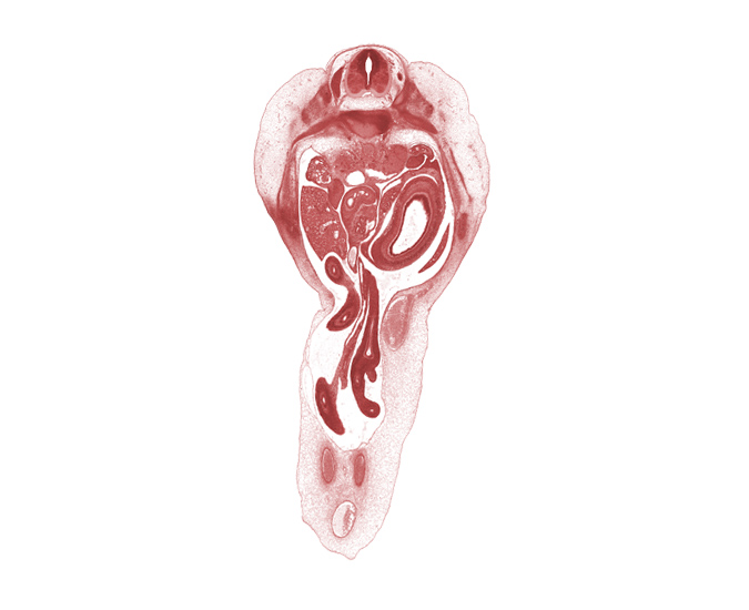 allantois, caudal edge of left lobe of liver, cephalic edge of T-12 spinal ganglion, distal limb of herniated midgut, duodenum (second part), left umbilical artery, lesser sac (omental bursa), mesonephros, midgut mesentery, osteogenic layer, proximal limb of herniated midgut, proximal limb of herniated midgut (jejunum), rib 12, right umbilical artery, spleen, splenic vein, superior mesenteric artery, superior mesenteric vein, umbilical vein, ventral pancreas