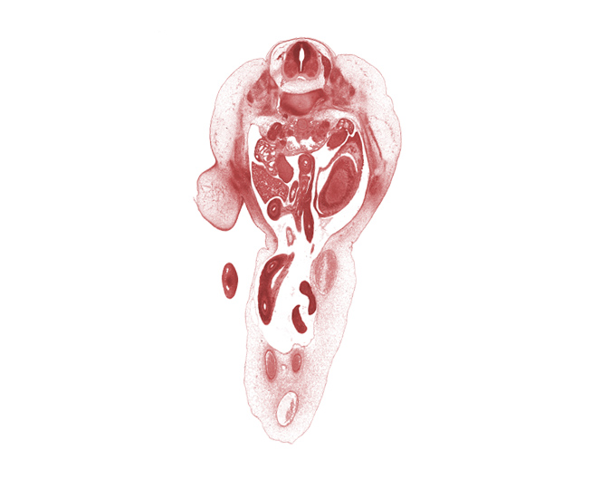 T-12 / L-1 intervertebral disc, T-12 spinal ganglion, T-12 spinal nerve, amnion on surface of umbilical cord, aorta, central canal, condensation in wall of proximal limb of herniated midgut, duodenum (third part), edge of distal limb of herniated midgut, edge of right umbilical artery, greater sac, junction of hindgut and midgut, marginal vein in foot, mesonephric duct, mesonephros, mucoid connective tissue, ovary, subarachnoid space, subcostal nerve (T-12), thigh, umbilical coelom, umbilical vein