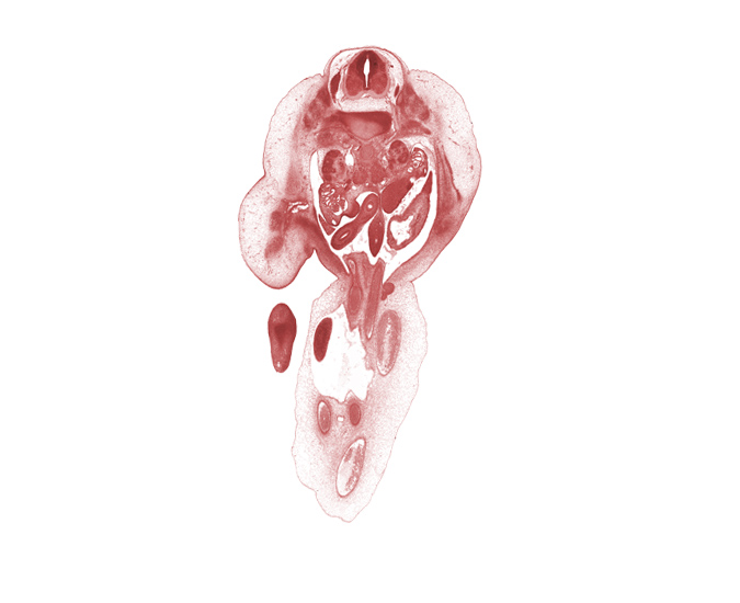 L-1 / L-2 intervertebral disc, L-1 spinal nerve, T-12 / L-1 interganglion region, allantois, amnion, aorta, caudal edge of herniated midgut, caudal edge of lesser sac (omental bursa), caudal edge of right lobe of liver, cephalic edge of L-1 spinal ganglion, dorsal mesogastrium, femoral artery, femoral vein, hindgut, inferior mesenteric artery, junction of allantois and apex of urinary bladder, kidney (metanephros), left umbilical artery, mesonephric duct, mesonephros, ovary, right umbilical artery, umbilical coelom, umbilical cord, umbilical vein