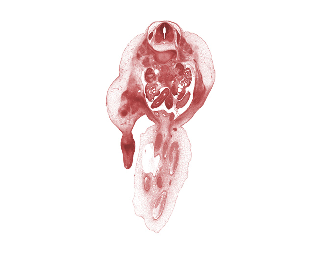 L-1 spinal ganglion, L-1 spinal nerve, allantois, apex of urinary bladder, caudal edge of mesogastrium, duodenum (fourth part), hindgut, inferior vena cava, kidney (metanephros), left umbilical artery, mesonephric duct, mesonephros, ovary, peritoneal cavity, proximal limb of midgut, right umbilical artery, umbilical coelom, umbilical vein