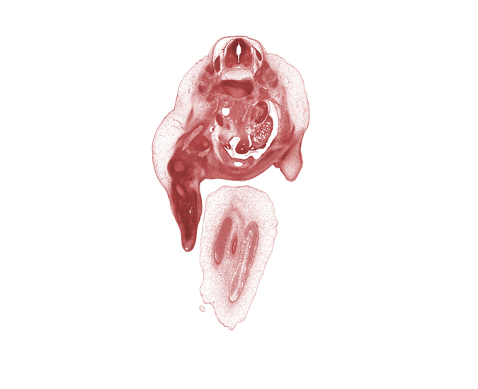 L-1 / L-2 intervertebral disc, L-1 spinal ganglion, blastemata of deep back muscles, caudal edge of kidney (metanephros), edge of anterior thigh, edge of left umbilical artery, femoral nerve, hindgut, inferior mesenteric artery, infra-umbilical part of anterior abdominal wall, kidney (metanephros), mesonephric duct, mesonephros, peritoneal cavity, right umbilical artery, umbilical vein, urinary bladder