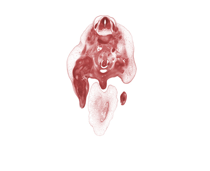 L-2 spinal ganglion, aortic bifurcation, caudal edge of kidney (metanephros), external iliac artery, femur, glans clitoris, hindgut, inferior vena cava, left ureter, marginal vein, mesonephric duct, primordial phallus, right common iliac artery, right ureter, subarachnoid space, umbilical cord, umbilical vein, urinary bladder