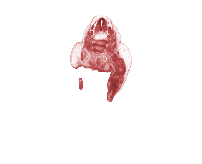 L-4 spinal ganglion, L-5 / S-1 intervertebral disc, L-5 ventral primary ramus, S-1 / S-2 intervertebral region, S-1 ventral primary ramus, S-2 / S-3 intervertebral region, S-2 ventral primary ramus, ala of sacrum, alar plate(s), anal pit, basal plate, blastemata of flexor muscles in leg, central canal, dorsal surface of foot, foot plate, marginal vein, notochord, sacral plexus, sulcus limitans