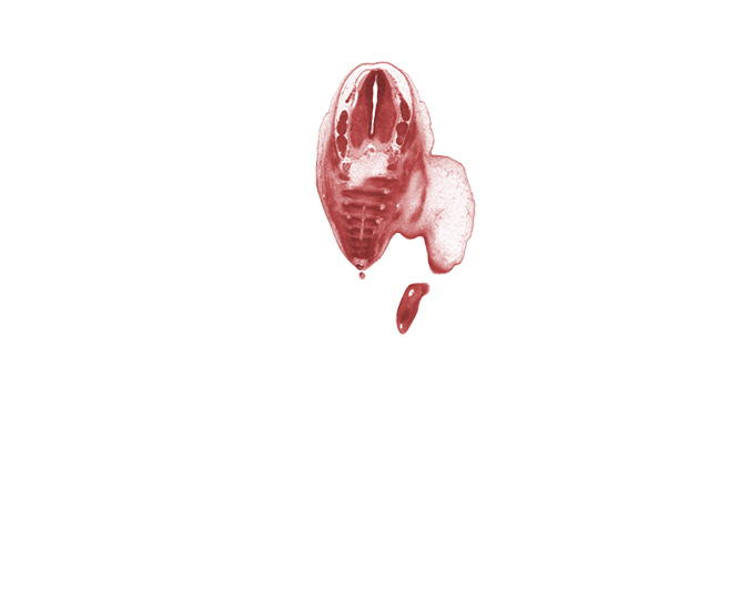 Co-1 ventral primary ramus, L-5 spinal ganglion, S-1 spinal ganglion, S-2 spinal nerve, S-3 spinal nerve, S-4 / S-5 intervertebral region, S-4 ventral primary ramus, S-5 ventral primary ramus, alar plate(s), basal plate, dorsal fasciculus, edge of caudal eminence, filum terminale, floor plate, marginal vein, notochord, roof plate, sulcus limitans