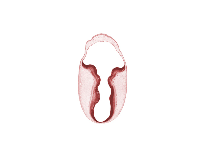 cephalic edge of osteogenic layer, cerebral aqueduct (mesencoel), external cerebellum, head mesenchyme, intermediate zone, internal cerebellum, marginal zone, rhombencoel (fourth ventricle), trochlear nerve (CN IV), ventricular zone