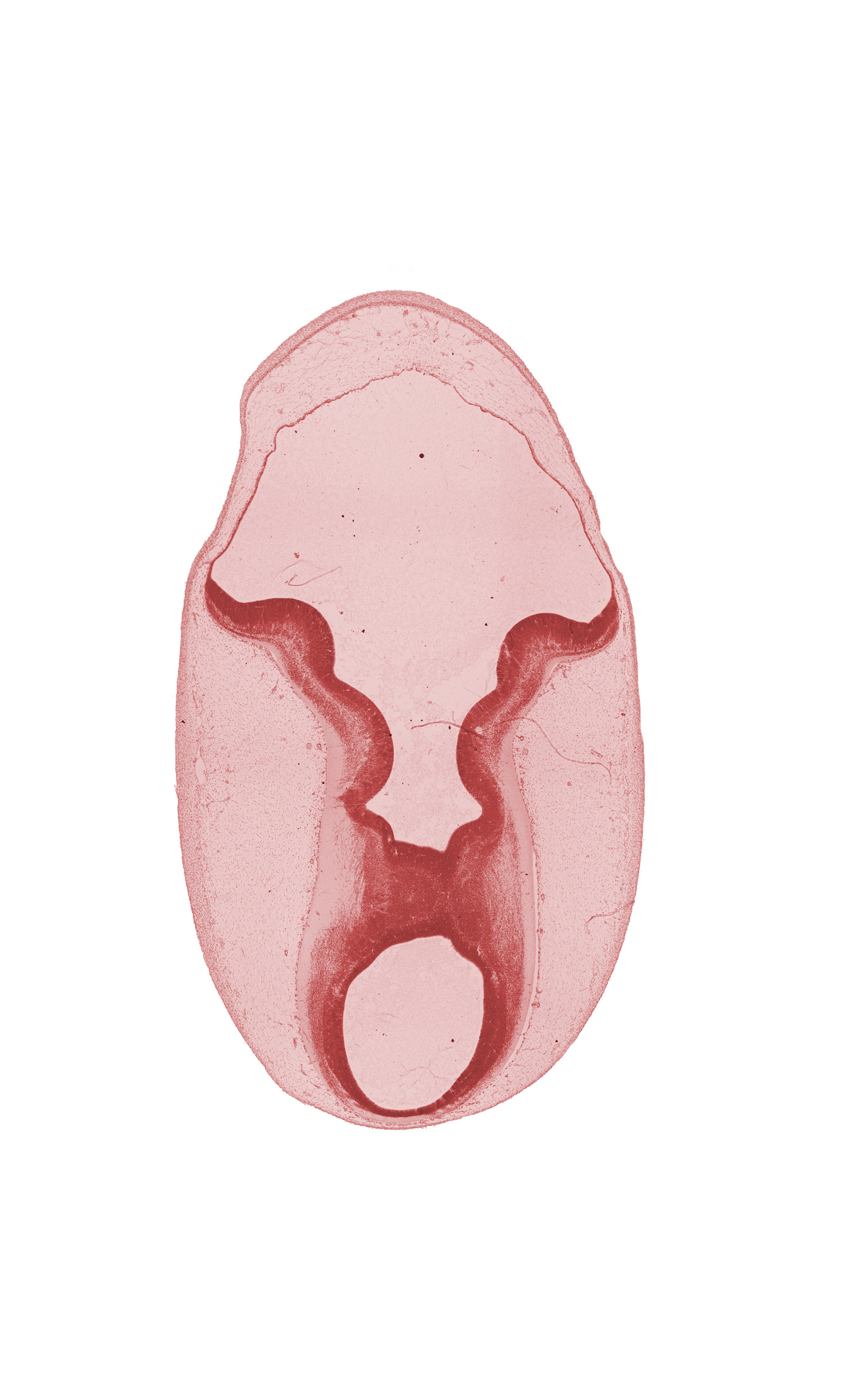 cerebral aqueduct (mesencoel), head mesenchyme, intermediate zone, marginal zone, rhombencoel (fourth ventricle), rhombic lip, subarachnoid space, sulcus limitans, surface ectoderm, ventricular zone