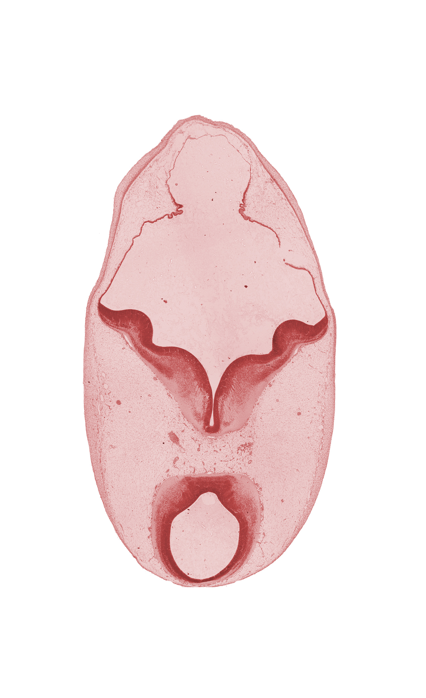 alar plate of metencephalon (cerebellum), artifact separation(s), basal plate, cerebral peduncle, diverticulum of rhombencoel (fourth ventricle), floor plate, osteogenic layer, region of mesencephalic (cephalic) flexure, roof plate, root of oculomotor nerve (CN III), sulcus limitans, surface ectoderm, tectum, tegmentum