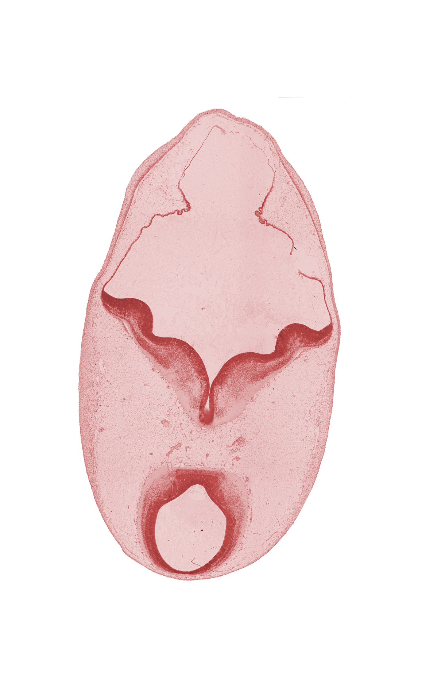 alar plate (tectum), alar plate of metencephalon (cerebellum), artifact separation(s), basal plate (tegmentum), basal plate of metencephalon, mesencephalon, oculomotor nerve (CN III), primordial choroid plexus, sulcus limitans, trochlear nerve (CN IV)