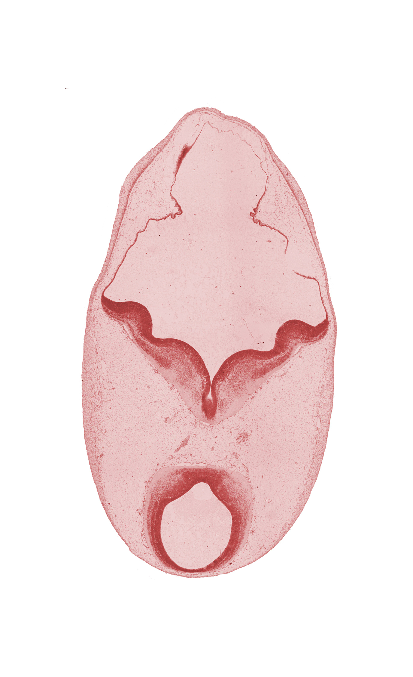 artifact separation(s), cerebral aqueduct (mesencoel), diverticulum of rhombencoel (fourth ventricle), edge of alar plate of myelencephalon, mesencephalon, oculomotor nerve (CN III), rhombencoel (fourth ventricle), trochlear nerve (CN IV)