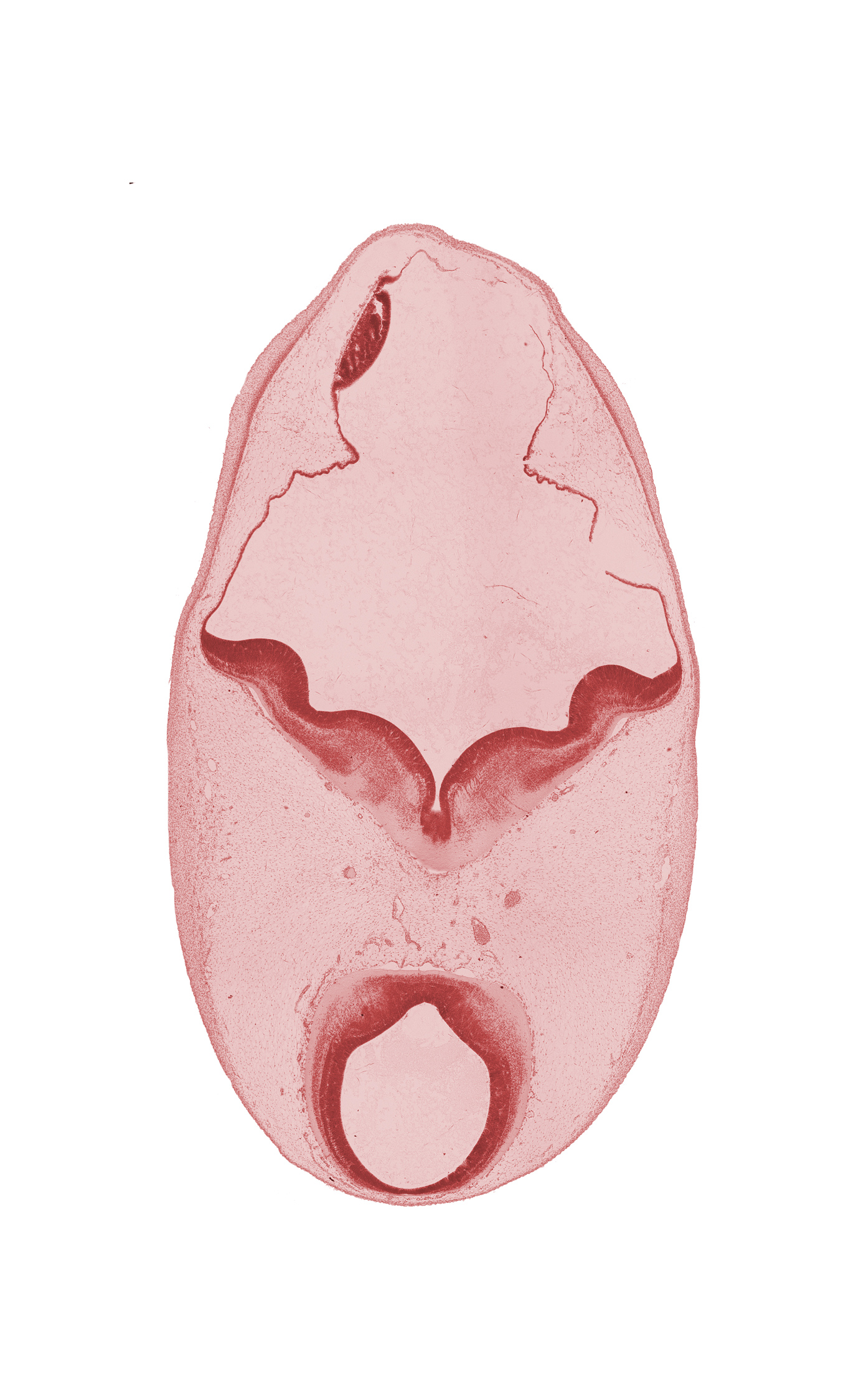 alar plate of myelencephalon, artifact separation(s), dural vein, oculomotor nerve (CN III), osteogenic layer, roof plate, subarachnoid space, surface ectoderm, trochlear nerve (CN IV), vascular plexus