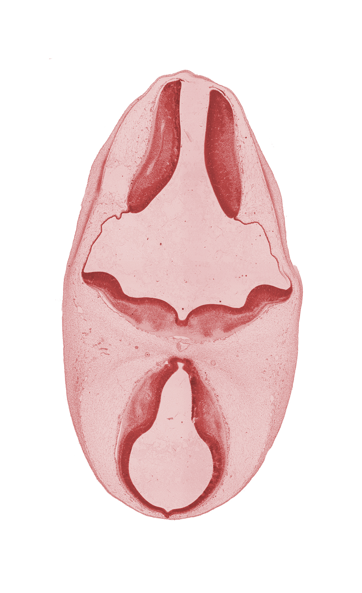 alar plate of metencephalon (cerebellum), artifact separation(s), basilar artery, basilar pons, mamillary recess, oculomotor nerve (CN III), pineal bud, rhombencoel (fourth ventricle), roof plate, third ventricle, trochlear nerve (CN IV)