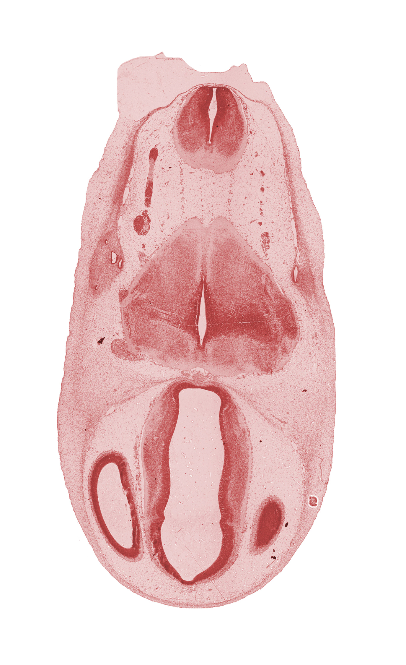 basilar artery, dorsal thalamus, edge of cerebral vesicle(s), endolymphatic sac, epithalamus, hypothalamus, lateral ventricle, osteogenic layer, pyramidal tract region, rhombencoel (fourth ventricle), root of accessory nerve (CN XI), subarachnoid space, third ventricle, transverse fascicle, vagus nerve (CN X), ventral thalamus