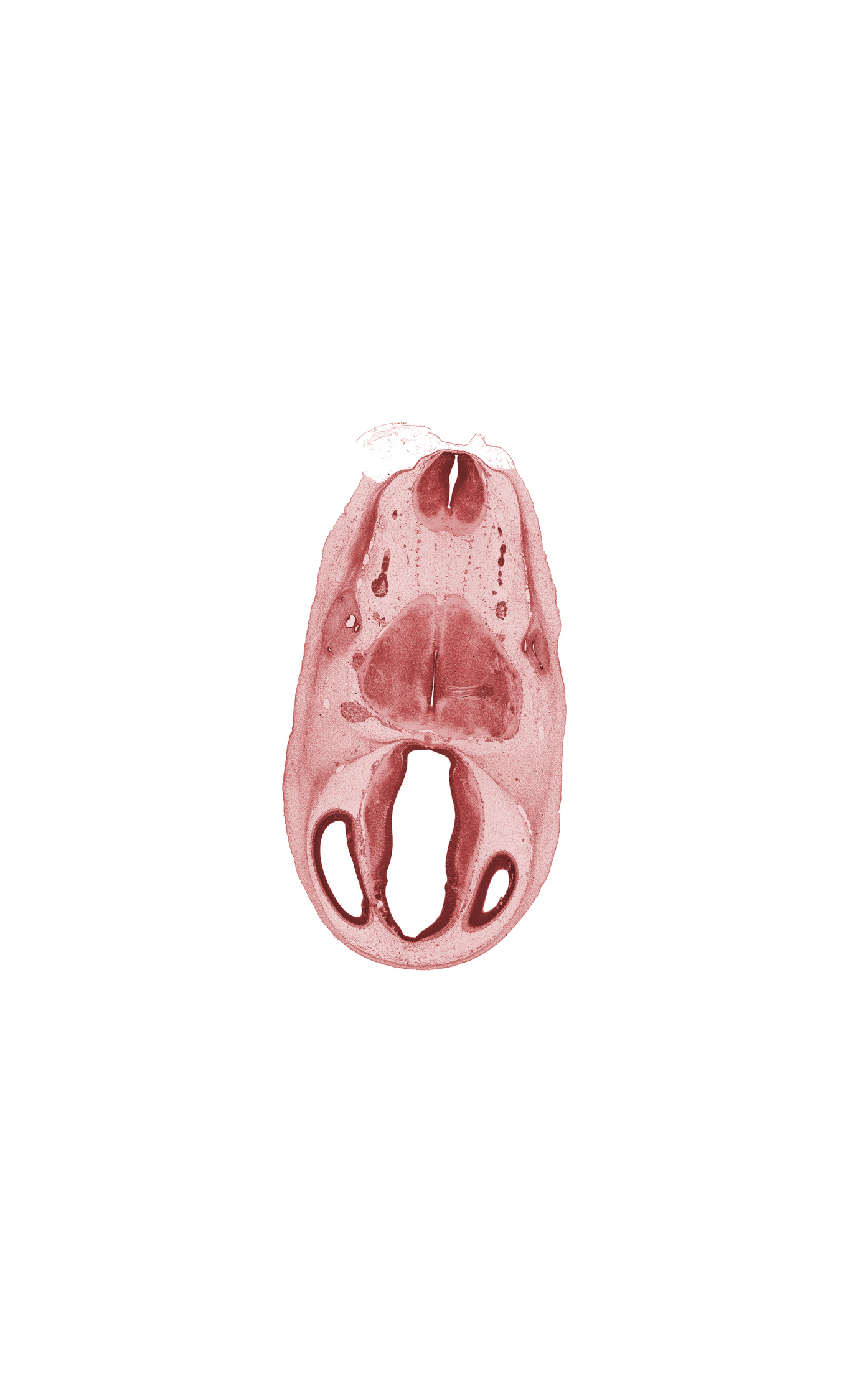 basilar artery, central canal, choroid vessel, decussation, edge of rhombencoel (fourth ventricle), head mesenchyme, lateral ventricle, osteogenic layer, posterior dural venous plexus, root of glossopharyngeal nerve (CN IX), root of hypoglossal nerve (CN XII), surface ectoderm, third ventricle, transverse fascicle