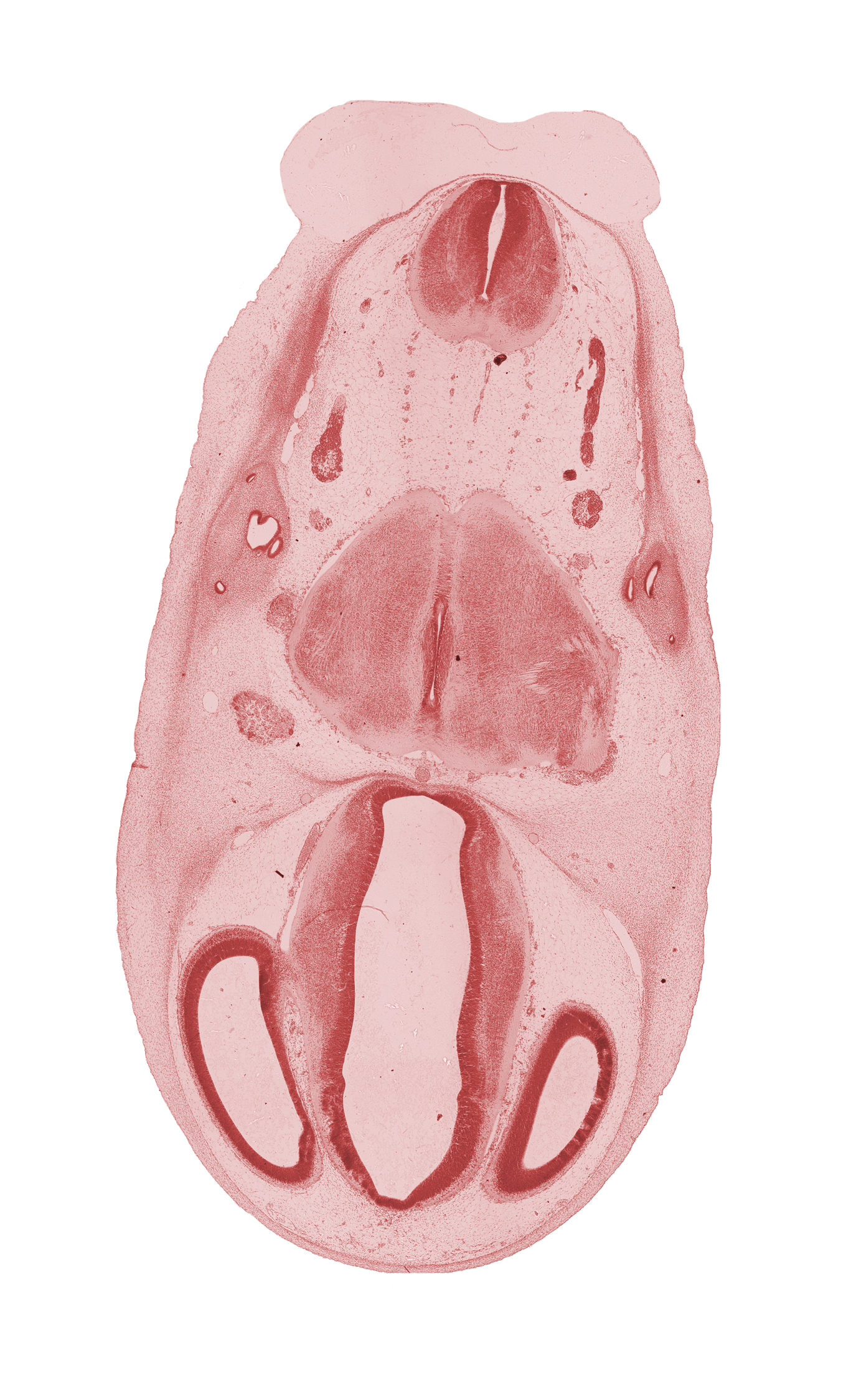 accessory nerve (CN XI), anterior semicircular duct, basal part of pons region (metencephalon), dorsal thalamus, endolymphatic duct, epithalamus, hypothalamus, intermediate zone, marginal zone, myelencephalon, pyramidal tract region, roof of diencephalon, roof plate, root of trigeminal nerve (CN V), spinal tract of trigeminal nerve (CN V), superior ganglion of vagus nerve (CN X), ventral thalamus, ventricular zone, vestibular part of otic vesicle