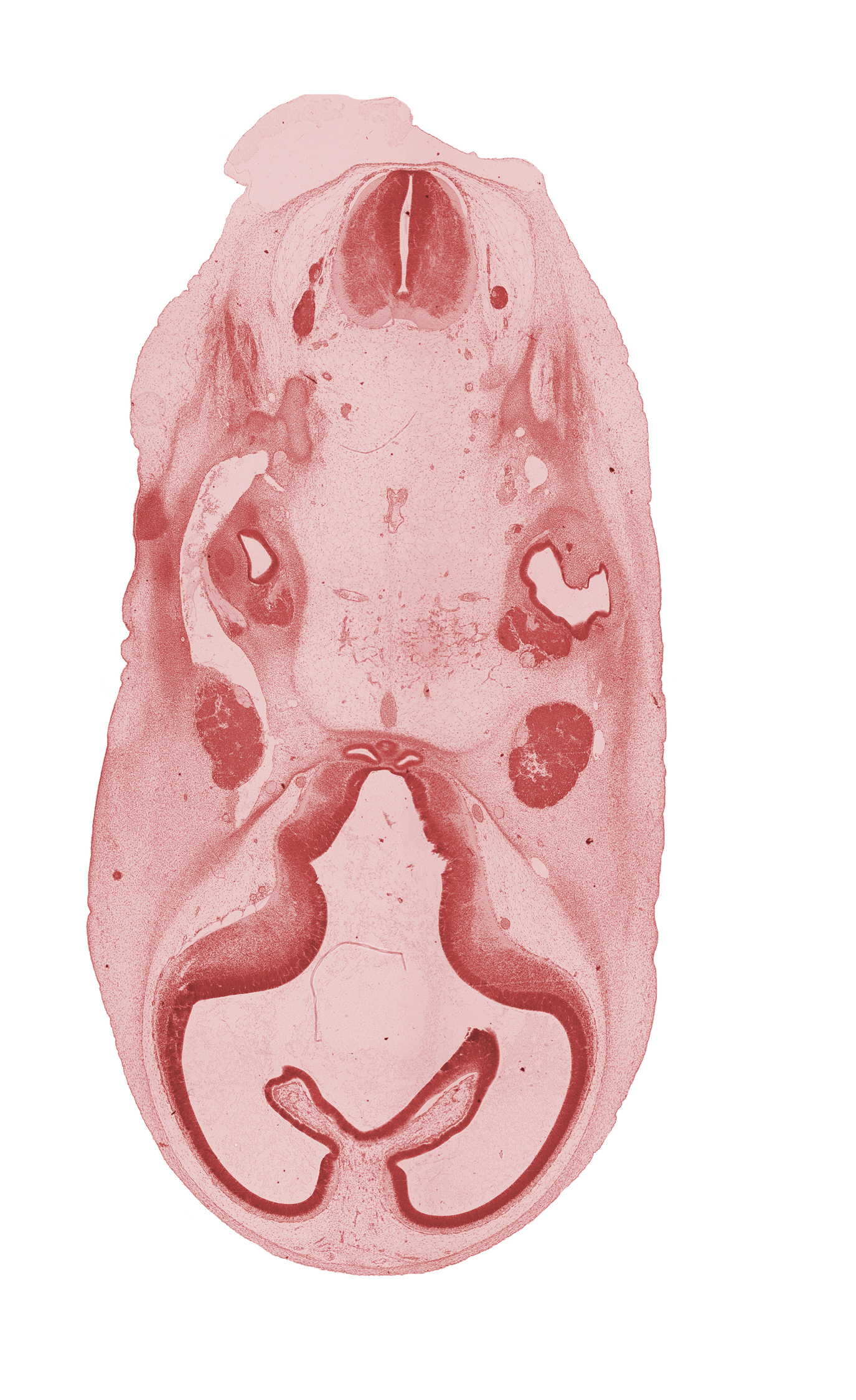 accessory nerve (CN XI), basilar artery, choroid fissure, corpus striatum, edge of pons region (metencephalon), hippocampal thickening, lateral semicircular duct, motor root of trigeminal nerve (CN V), neurohypophyseal bud, primary head vein, spinal accessory nerve (CN XI), subarachnoid space, torus hemisphericus, trigeminal ganglion (CN V), tuberal part of adenohypophysis, vagus nerve (CN X), vertebral artery, vestibular part of otic vesicle