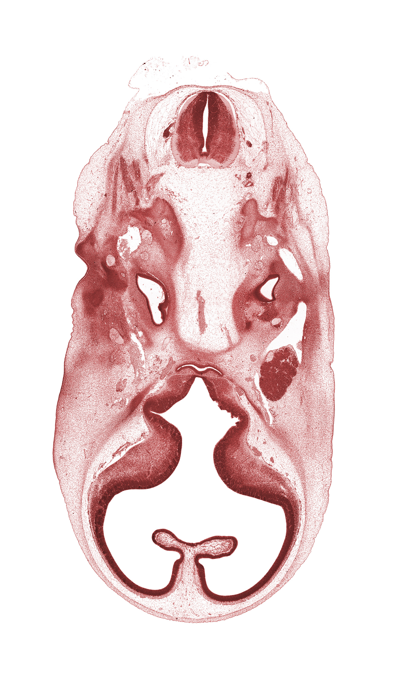 C-1 spinal ganglion, abducens nerve (CN VI), adenohypophysis, basilar artery, central canal, cochlear duct, facial nerve (CN VII), glossopharyngeal nerve (CN IX), hippocampal thickening, hypoglossal nerve (CN XII), junction of brain and spinal cord, junction of precardinal and primary head veins, spinal accessory nerve (CN XI), subarachnoid space, trigeminal ganglion (CN V), vagus nerve (CN X), vertebral artery