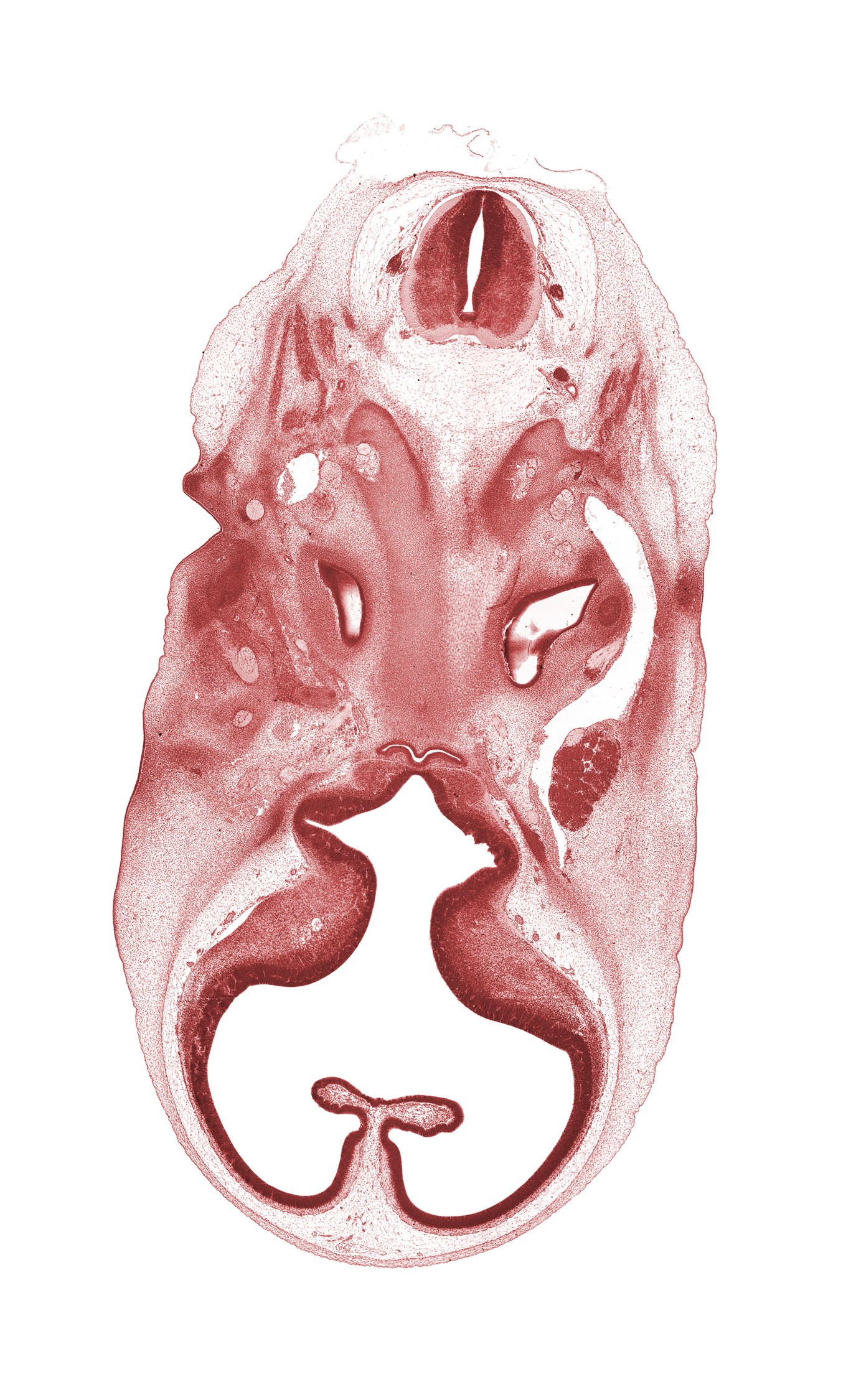 C-1 spinal ganglion, C-1 ventral root, accessory nerve (CN XI), adenohypophysis, basi-occipital (basal plate), central canal, choroid fissure, cochlear duct, geniculate ganglion (CN VII), hypoglossal canal, interventricular foramen, lateral ventricle, motor root of trigeminal nerve (CN V), optic groove, primary head vein, primordial choroid plexus, spinal accessory nerve (CN XI), spinal cord, third ventricle, vagus nerve (CN X), vertebral artery