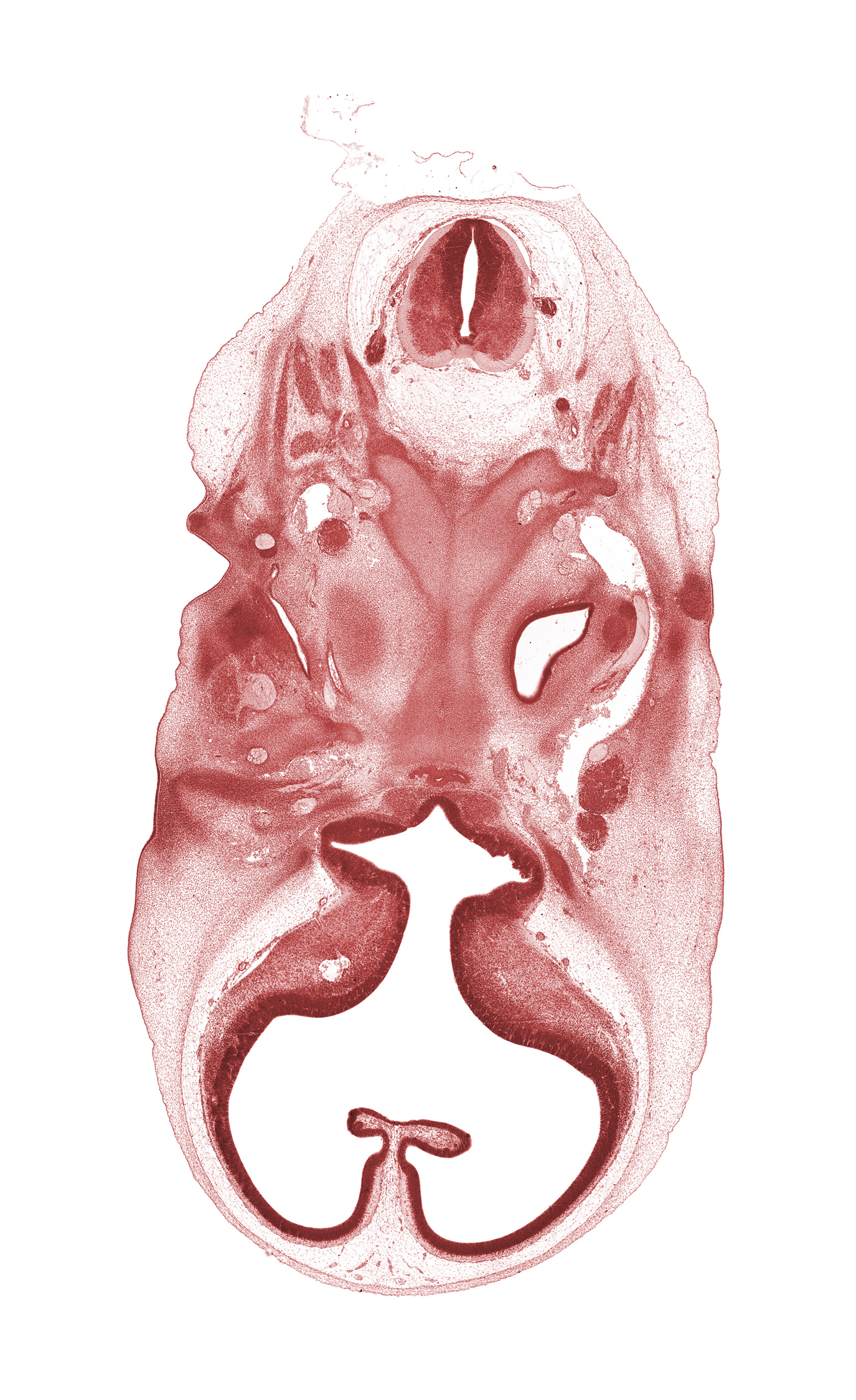 C-1 spinal ganglion, C-1 ventral root, adenohypophysis, basi-occipital (basal plate), cerebral vesicle (telencephalon), cochlear duct, corpus striatum, edge of pharyngotympanic tube, glossopharyngeal nerve (CN IX), horizontal part of facial nerve (CN VII), hypoglossal nerve (CN XII), internal carotid artery, neural arch of C-1 vertebra (atlas), orbitosphenoid, semispinalis capitis muscle, spinal accessory nerve (CN XI), splenius muscle, suboccipital muscle, third ventricle, trapezius muscle, vertebral artery