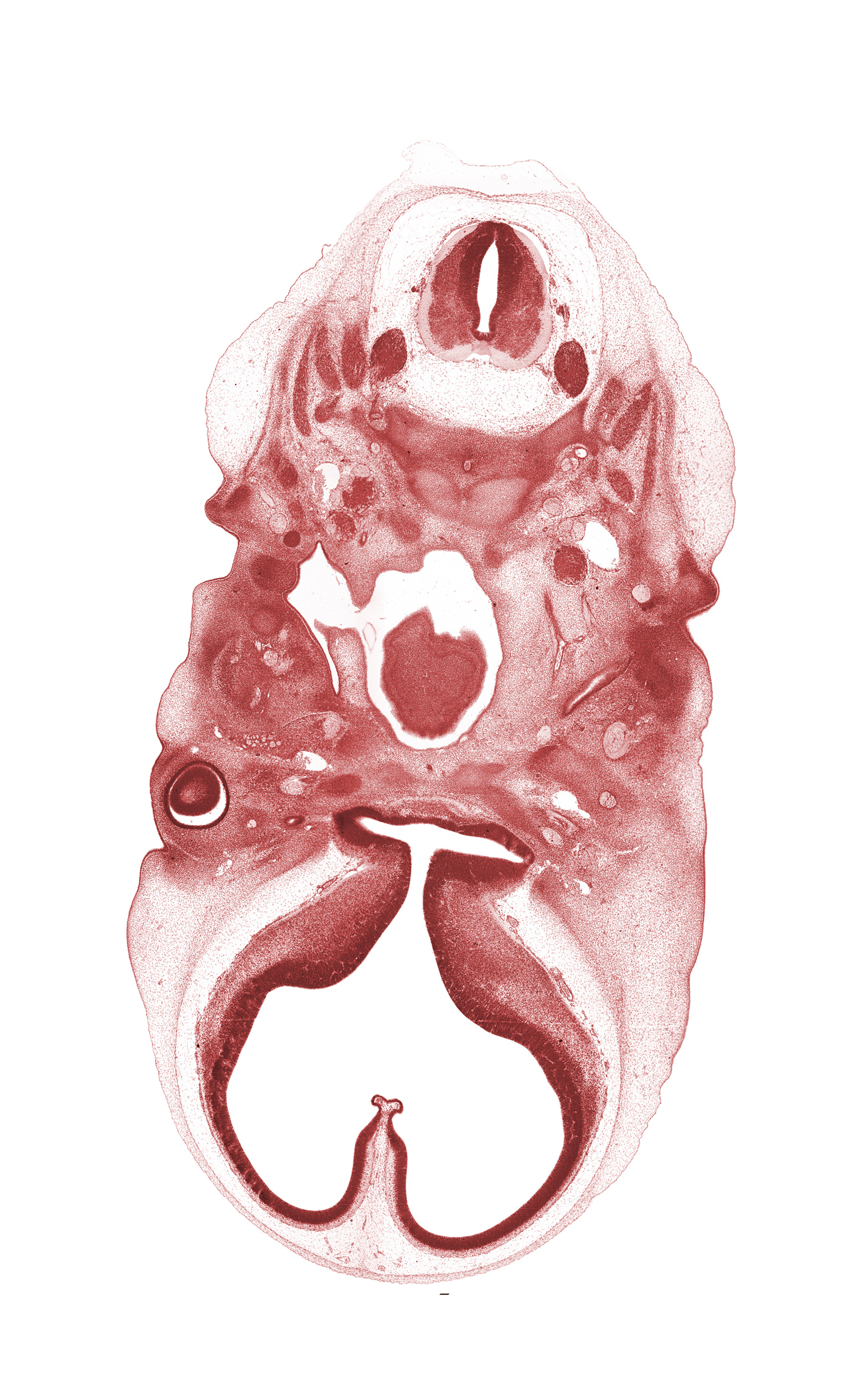 C-1 spinal nerve, C-1 vertebra (atlas), C-2 spinal ganglion, C-2 ventral root, atlanto-occipital joint, auricle, basi-occipital (basal plate), dens of C-2 vertebra (axis) region, edge of tongue, facial nerve (CN VII), falx cerebri region, head mesenchyme, hippocampal thickening, interventricular foramen, lateral ventricle, nasopharynx, notochord, optic chiasma (chiasmatic plate), optic groove, optic stalk (CN II), optic ventricle, oropharynx, paraphysis, spinal accessory nerve (CN XI), stem of adenohypophysis, subarachnoid space, third ventricle, vertebral artery