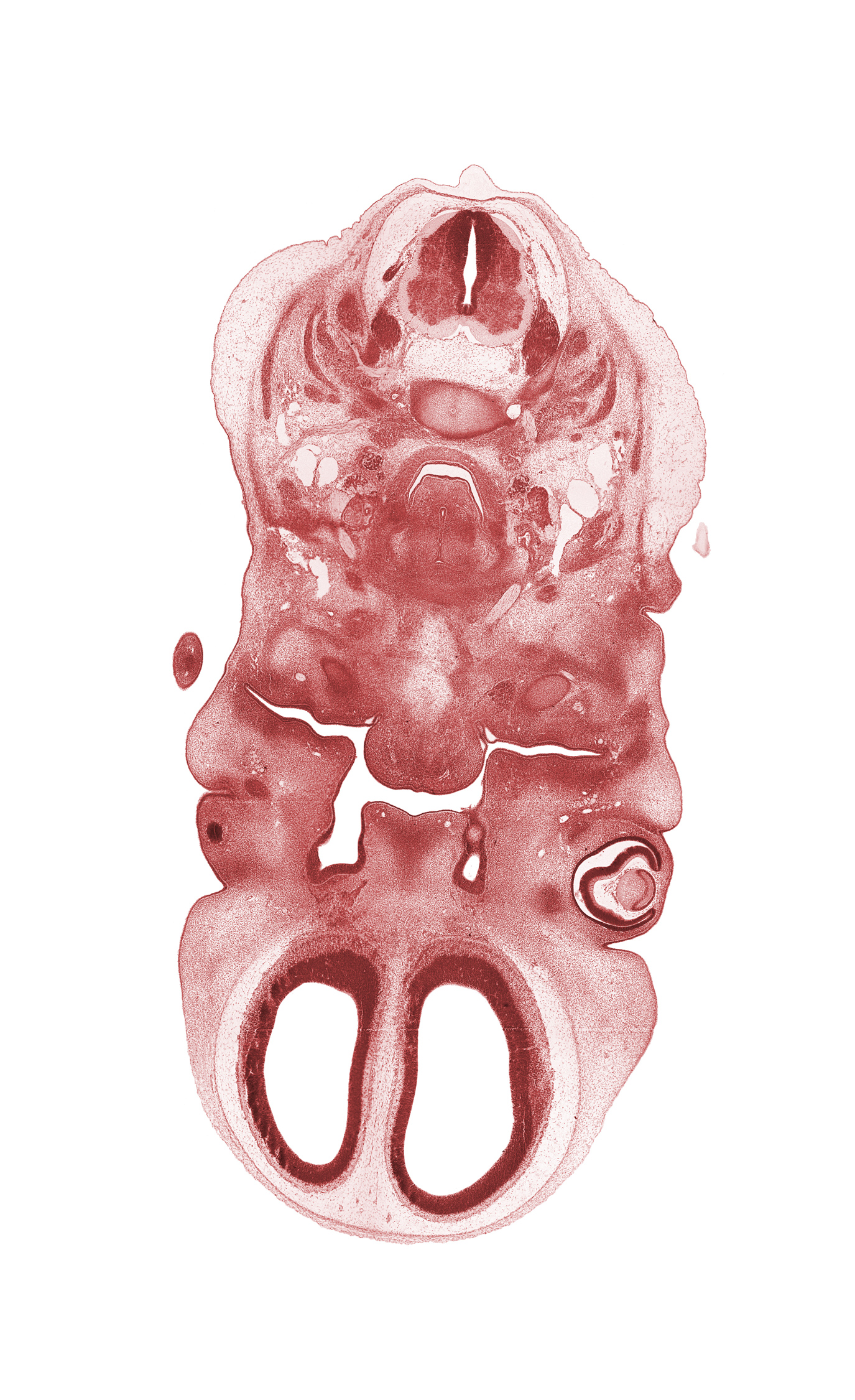 C-3 ventral primary ramus, C-4 spinal ganglion, centrum of C-3 vertebra, cornea, edge of nasal cavity (nasal sac), edge of upper limb, hypoglossal nerve (CN XII), intraretinal space (optic vesicle cavity), laryngeal condensation, laryngeal pharynx, lens, medial wall of cerebral vesicle (telencephalon), middle pharyngeal constrictor muscle, nasal septal cartilage condensation, neural arch of C-3 vertebra, optic cup cavity, oral cavity, palatine shelf, pharyngeal arch 1 cartilage (Meckel), retropharyngeal space, sternocleidomastoid muscle, vertebral artery, vestibule of oral cavity