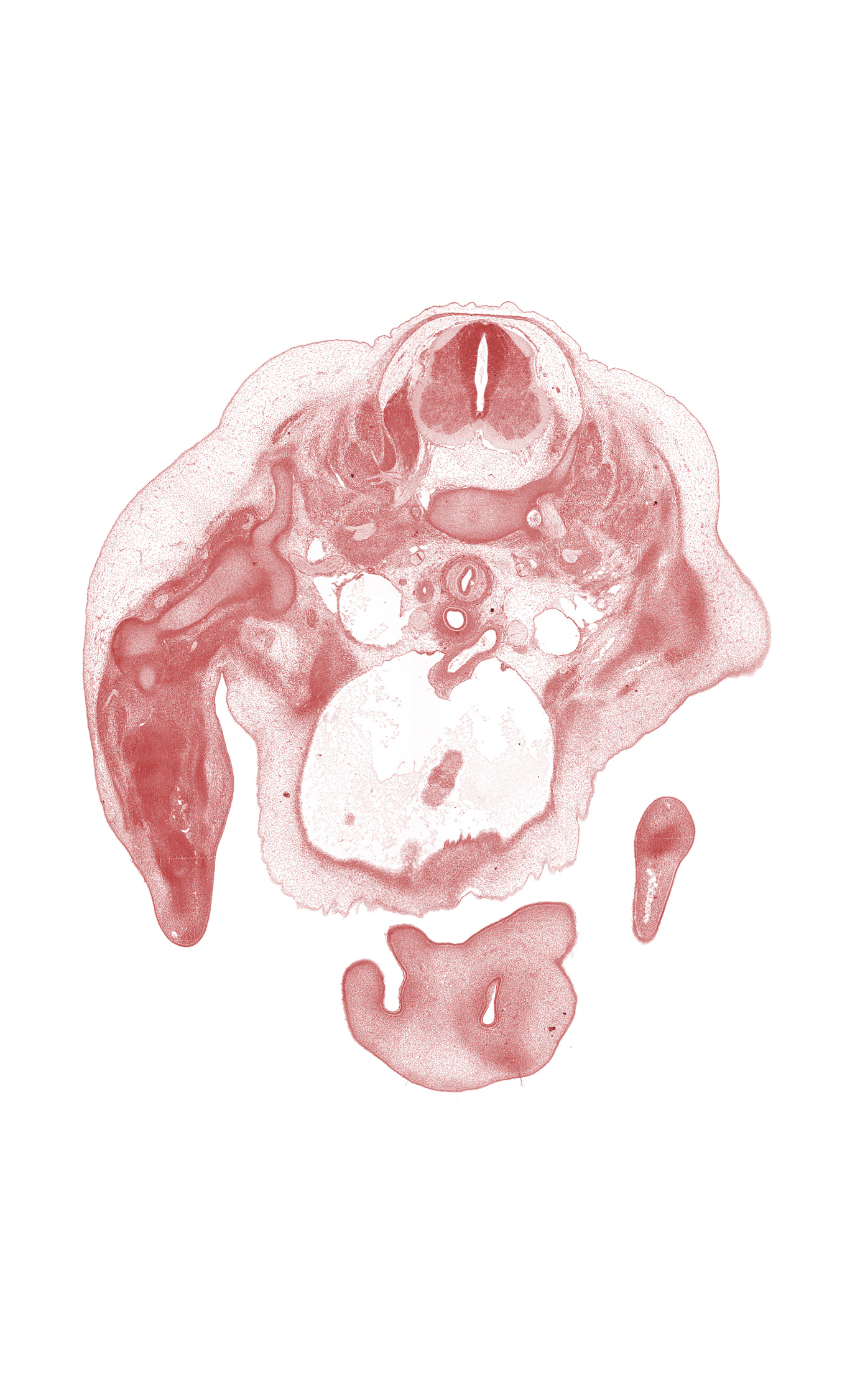 C-6 / C-7 interganglion region, C-6 spinal nerve, arch of aorta, blastemata of extensor muscles in forearm, blastemata of flexor muscles in forearm, dorsum of hand, edge of right ventricle, glenohumeral joint, marginal vein, maxillary prominence of pharyngeal arch 1, medial nasal prominence(s), naris, nasal cavity (nasal sac), pericardial cavity, radial nerve, scapula, subarachnoid space, subclavian artery, vagus nerve (CN X), vertebral artery