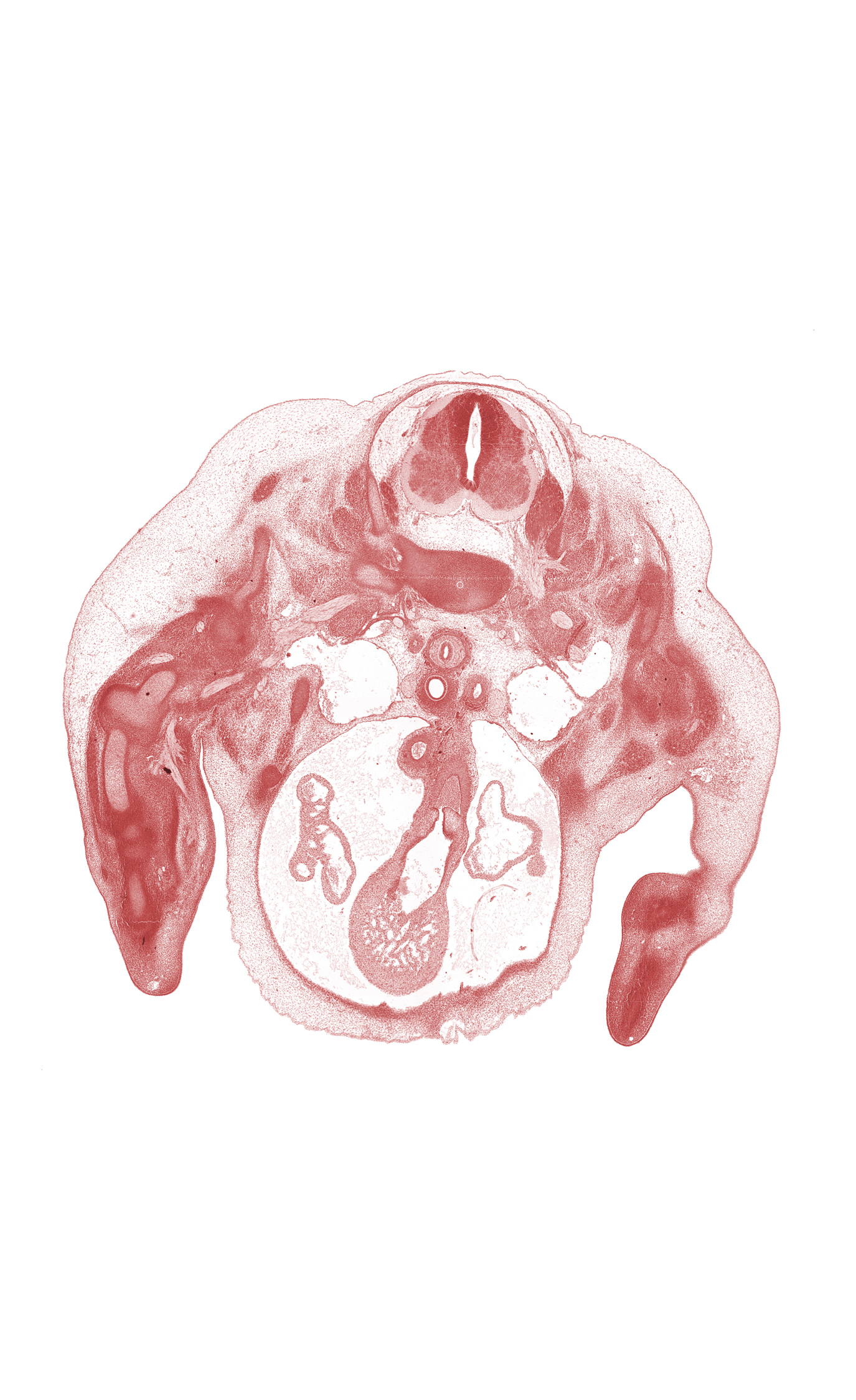 C-5 ventral primary ramus, C-6 / C-7 intervertebral disc, C-6 ventral primary ramus, C-7 dorsal primary ramus, C-7 spinal ganglion, C-7 spinal nerve, aorta, ascending aorta, dorsal surface of hand plate, esophagus, humerus, infundibulum of right ventricle, left atrium, notochord, precardinal vein, pulmonary artery, pulmonary semilunar valve, pulmonary semilunar valve cusp, right atrium, subclavian artery, trabecular part of right ventricle, trachea