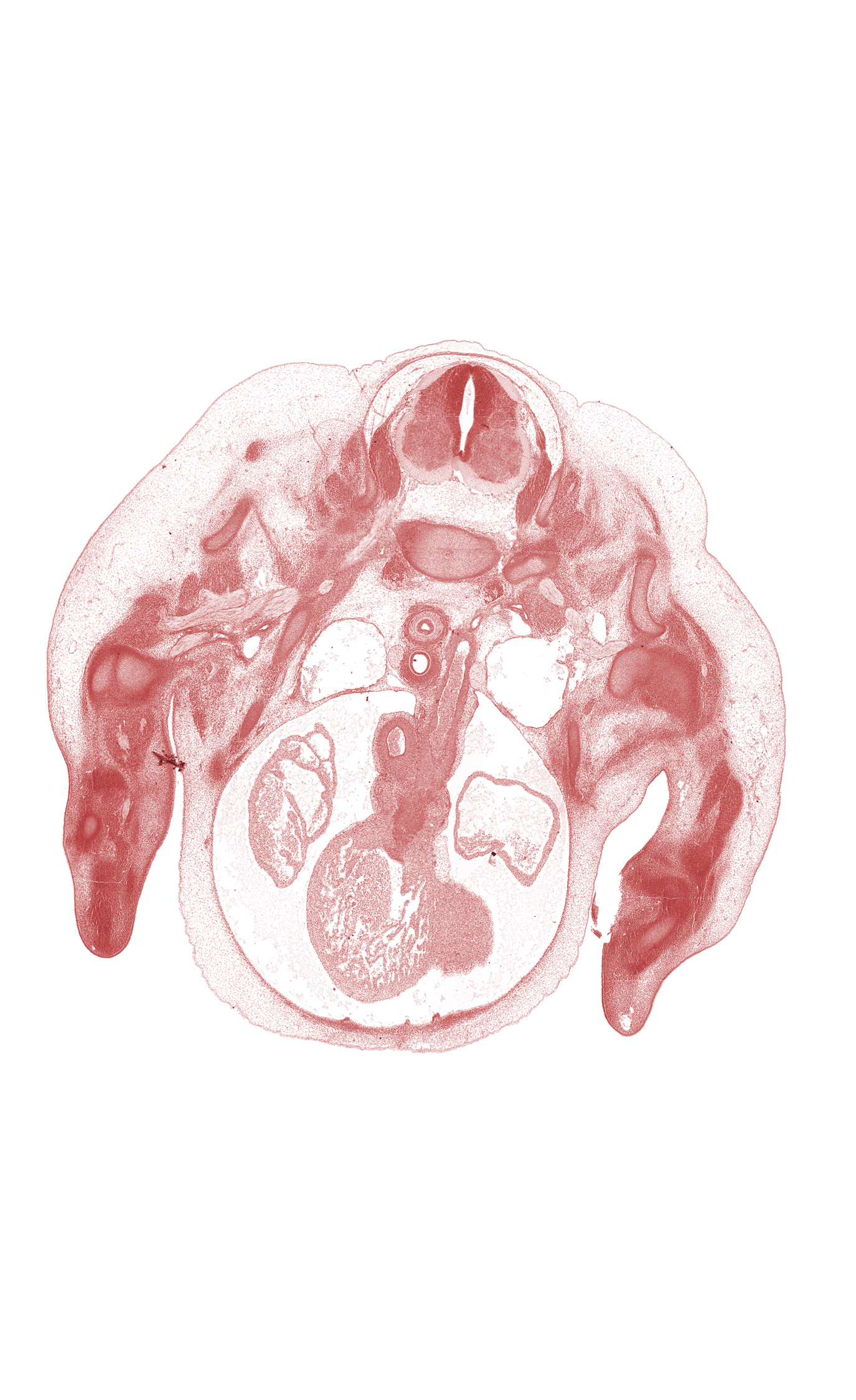 C-7 ventral primary ramus, C-8 spinal ganglion, aorta, aorticopulmonary septum region, ascending aorta, ductus arteriosus, edge of left ventricle, esophagus condensation, inferior cervical sympathetic ganglion, interventricular sulcus, left atrium, left vagus nerve (CN X), neural arch, osteogenic layer, pericardial cavity, precardinal vein, pulmonary trunk, rib 1, right atrium, right ventricle, subarachnoid space, tracheal condensation