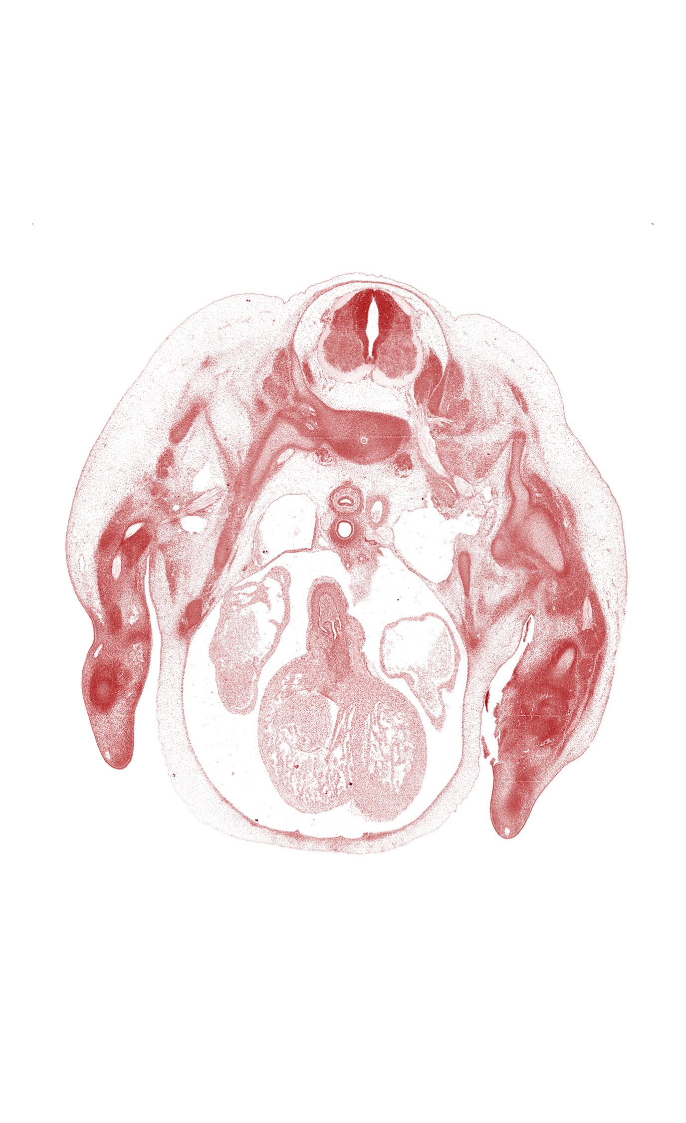 C-7 / T-1 intervertebral disc, C-7 ventral ramus, C-8 spinal ganglion, C-8 spinal nerve, aorta, aorticopulmonary septum region, artifact separation(s), ascending aorta, dorsal fasciculus, esophagus, glenohumeral joint, head of humerus, heart prominence, interventricular sulcus, left atrium, osteogenic layer, pulmonary trunk, radial nerve, radius, rib 1, right pulmonary artery, scapula, serratus anterior muscle, trabecular part of left ventricle, trabecular part of right ventricle, trachea
