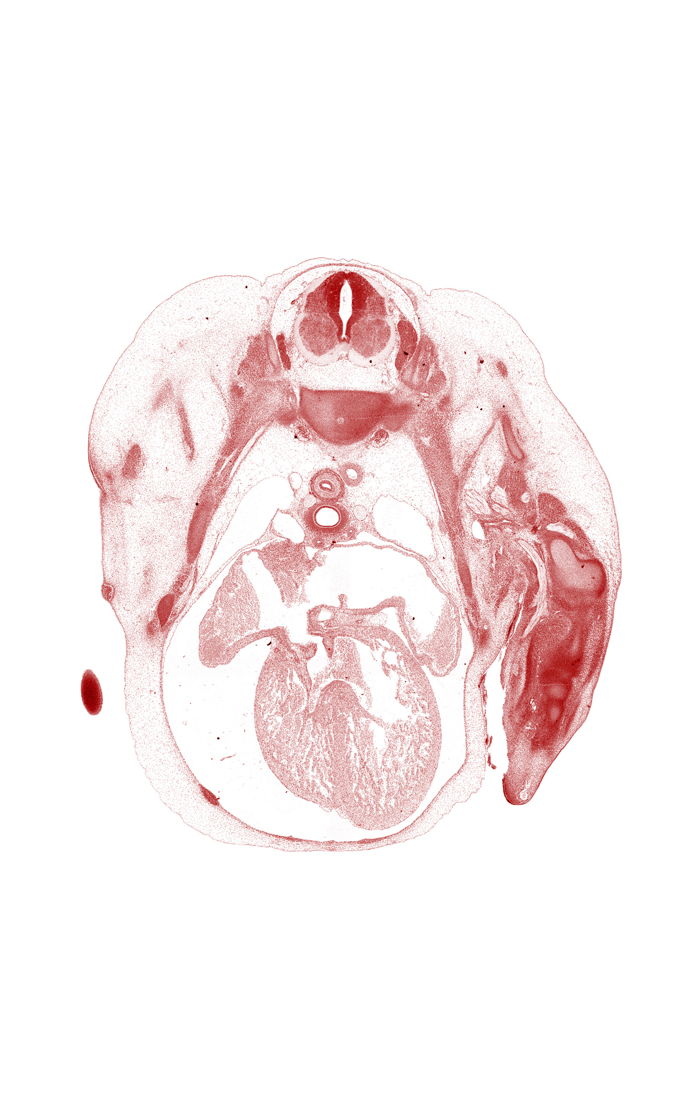 T-2 spinal ganglion, aorta, artifact separation(s), edge of hand, edge of pleural cavity, esophagus, head of rib 2, interventricular foramen, left atrium, left precardinal vein, left pulmonary artery, mammary gland, primary interatrial septum (septum primum) remnant, right atrioventricular canal, right atrium, right precardinal vein, secondary interatrial septum (septum secundum), sympathetic trunk, ventral horn of grey matter