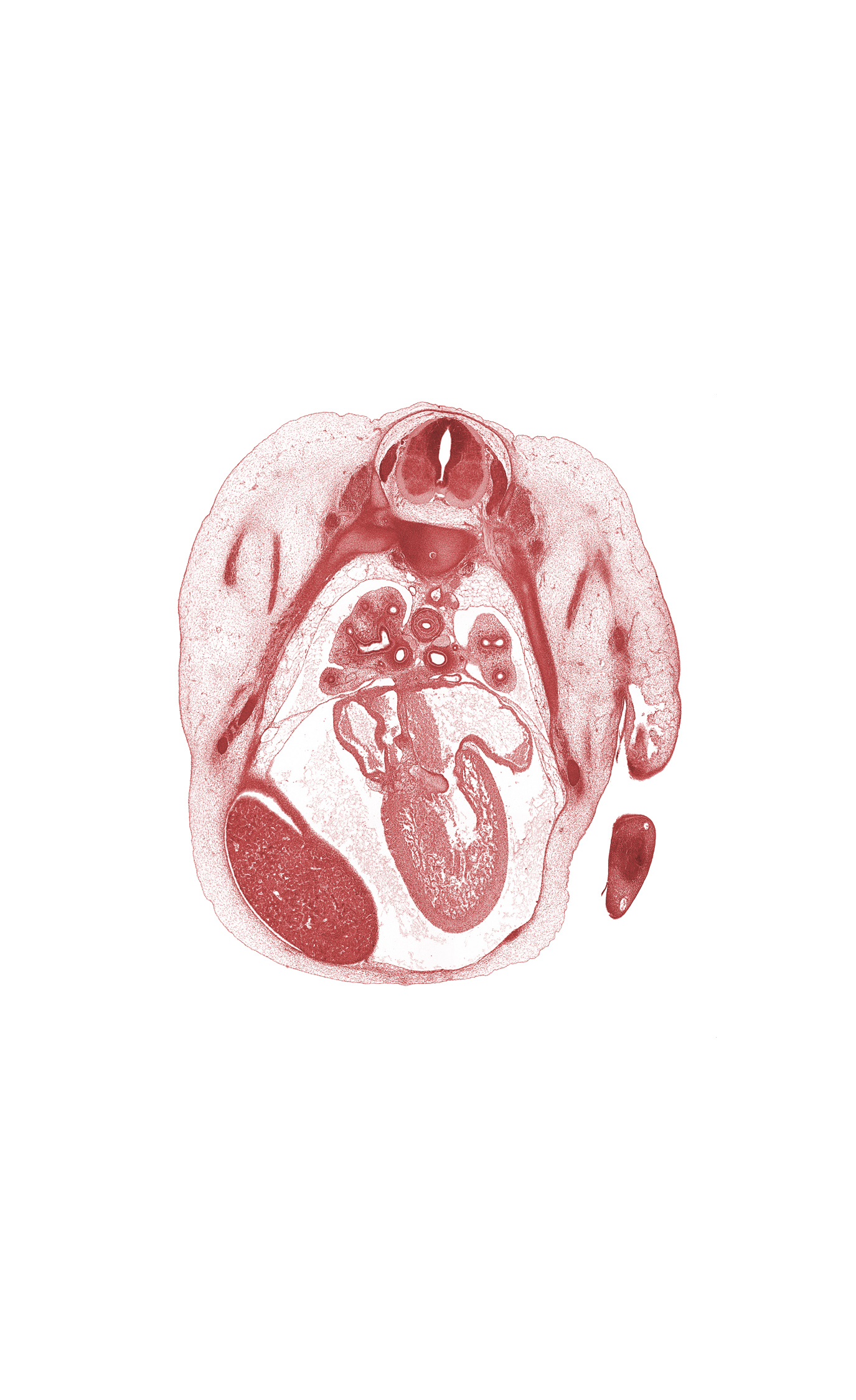 T-4 / T-5 intervertebral disc, T-4 intercostal nerve, T-4 spinal ganglion, anterior tertiary bronchus, aorta, atrioventricular endocardial cushion(s), central canal, horizontal fissure, left atrioventricular canal, left atrium, left horn of sinus venosus, left postcardinal vein, left ventricle, middle lobe of right lung, pericardial cavity, peritoneal cavity, phrenic nerve, posterior tertiary bronchus, primary bronchus, rib 4, rib 5, right atrium, sinus venosus, upper lobe of left lung, upper lobe of right lung, upper secondary bronchus