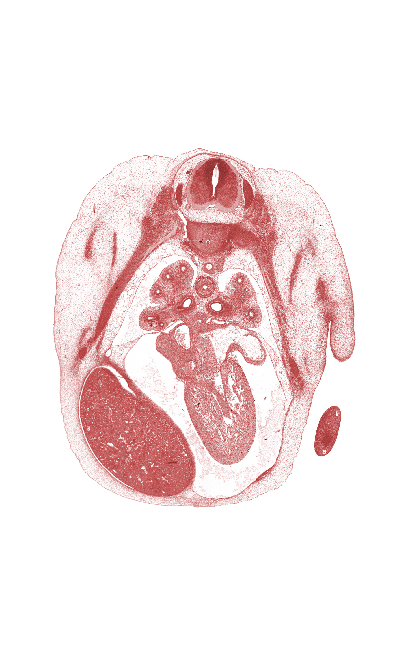 T-4 intercostal nerve, T-4 spinal ganglion, aorta, head of rib 5, heart prominence, horizontal fissure, latissimus dorsi muscle, left horn of sinus venosus, left ventricle, liver prominence, marginal vein, middle lobe of right lung, musculi pectinati, primary bronchus, pulmonary vein(s), rib 5, right atrium, right lobe of liver, right postcardinal vein (azygos vein), serratus anterior muscle, sympathetic trunk, upper lobe of left lung, upper lobe of right lung