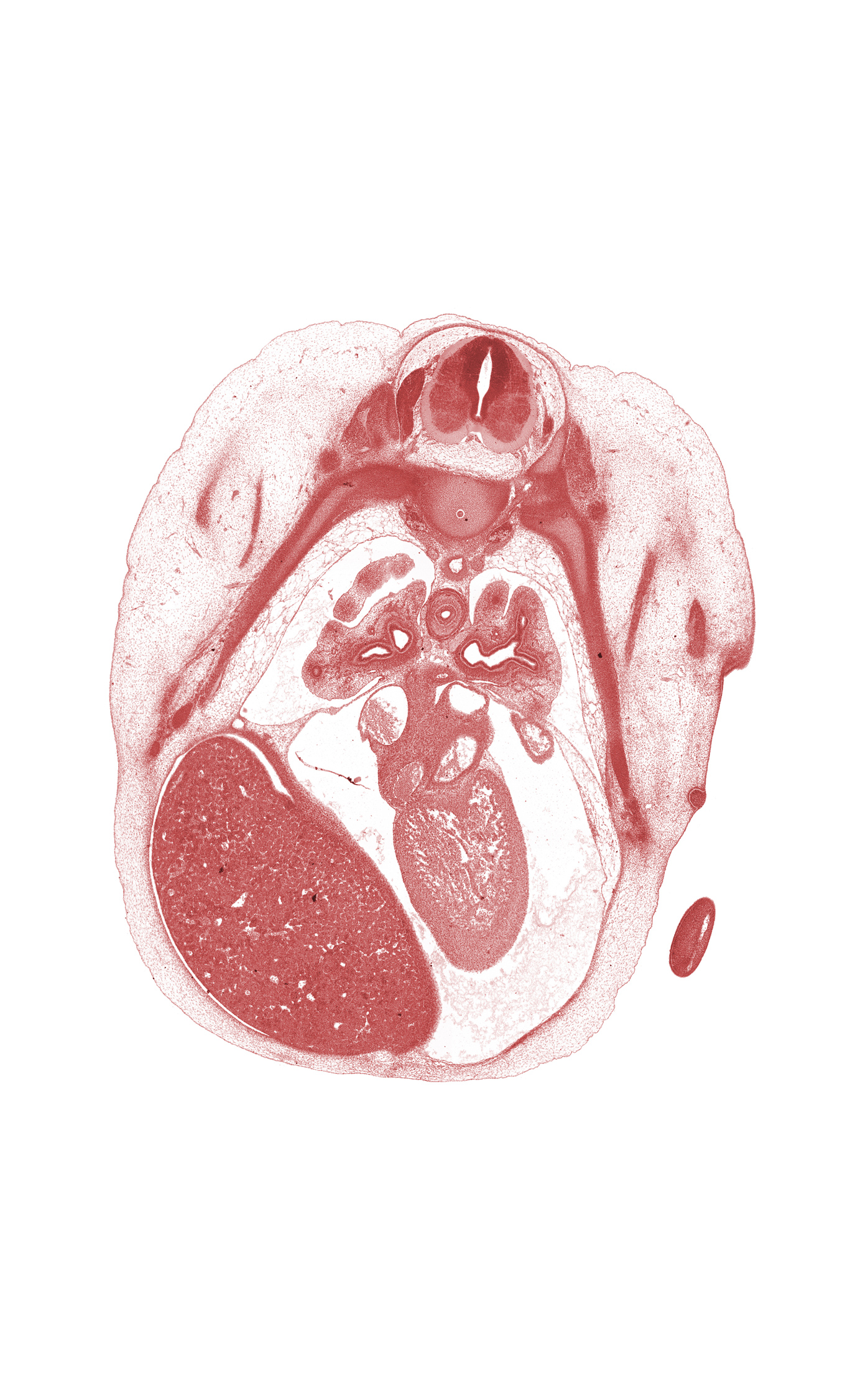 T-4 / T-5 interganglion region, apex of left ventricle, caudal edge of shoulder, central tendon of diaphragm, centrum of T-5 vertebra, edge of left atrium, edge of lower lobe of left lung, edge of lower lobe of right lung, lower lobe of left lung, lower secondary bronchus of left lung, mammary gland, middle lobe of right lung, muscular part of diaphragm, oblique fissure, pericardial cavity, peritoneal cavity, phrenic nerve, pleural cavity, rib 5, right lobe of liver, upper limb, upper lobe of left lung, upper secondary bronchus of left lung