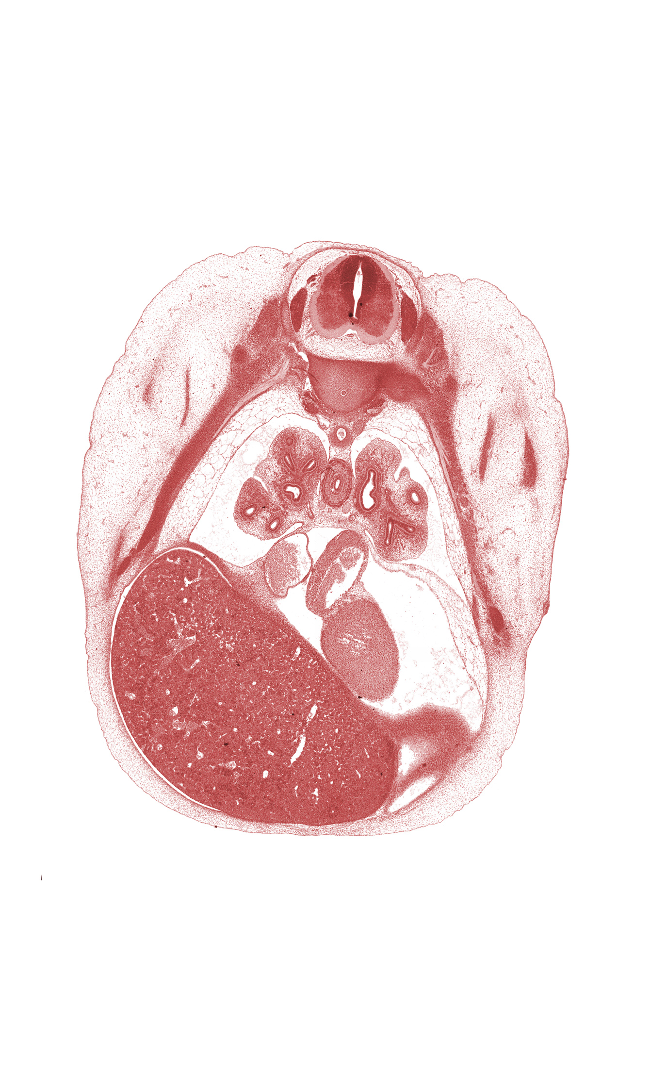 T-5 intercostal nerve, T-5 spinal ganglion, central tendon of diaphragm, edge of diaphragm, head of rib 6, inferior vena cava, left atrium, left ventricle, lower lobe of left lung, lower lobe of right lung, lower secondary bronchus of left lung, lower secondary bronchus of right lung, medial tertiary bronchus of right lung, middle lobe of right lung, oblique fissure, rib 6, right postcardinal vein (azygos vein), subarachnoid space, sympathetic trunk