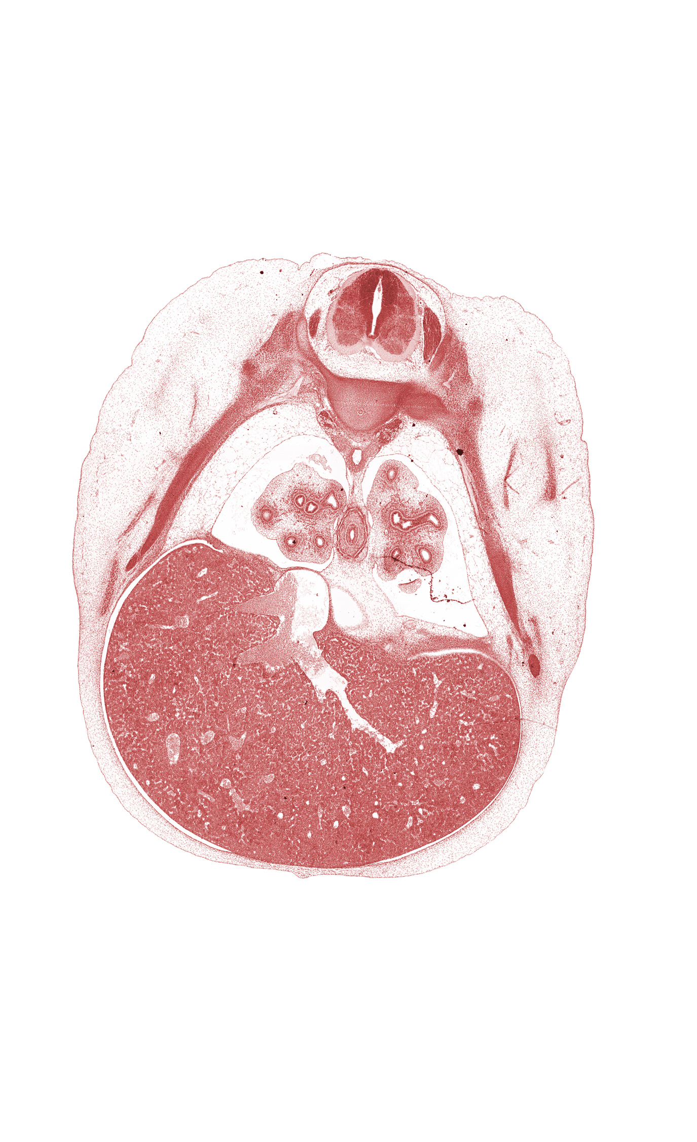 T-6 spinal ganglion, T-6 spinal nerve, anterior basal tertiary bronchus, common efferent hepatic vein, edge of lingula of upper lobe of left lung, edge of pericardial cavity, efferent hepatic veins, esophagus muscularis, head of rib 7, inferior vena cava, left efferent hepatic vein, lower lobe of right lung, osteogenic layer, peritoneal cavity, pleural cavity, rib 7, rib 8